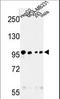 Microtubule Associated Serine/Threonine Kinase Like antibody, LS-C164044, Lifespan Biosciences, Western Blot image 