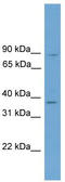 General Transcription Factor IIA Subunit 1 antibody, TA344433, Origene, Western Blot image 