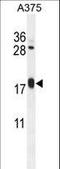 ADP Ribosylation Factor Like GTPase 8A antibody, LS-C156496, Lifespan Biosciences, Western Blot image 