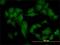 Casein Kinase 2 Alpha 1 antibody, H00001457-M01, Novus Biologicals, Immunocytochemistry image 