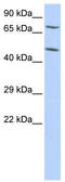 Zinc Finger Protein 672 antibody, TA345407, Origene, Western Blot image 