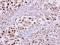 Karyopherin Subunit Alpha 2 antibody, GTX106323, GeneTex, Immunohistochemistry paraffin image 