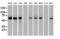 Checkpoint Kinase 2 antibody, LS-C114496, Lifespan Biosciences, Western Blot image 