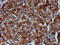 Tubulin Beta 4A Class IVa antibody, M05184-1, Boster Biological Technology, Immunohistochemistry paraffin image 