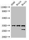 STIP1 Homology And U-Box Containing Protein 1 antibody, CSB-PA892480LA01HU, Cusabio, Western Blot image 