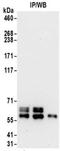 Ribophorin II antibody, NBP2-32178, Novus Biologicals, Immunoprecipitation image 