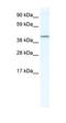 Cbp/P300 Interacting Transactivator With Glu/Asp Rich Carboxy-Terminal Domain 4 antibody, orb324684, Biorbyt, Western Blot image 