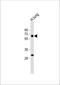 Calcitonin gene-related peptide type 1 receptor antibody, 59-491, ProSci, Western Blot image 