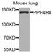 Protein Phosphatase 4 Regulatory Subunit 4 antibody, STJ110803, St John
