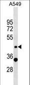 Zinc Finger Protein 19 antibody, LS-C157419, Lifespan Biosciences, Western Blot image 