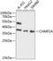 Charged multivesicular body protein 2a antibody, A07825, Boster Biological Technology, Western Blot image 