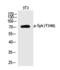 Spleen tyosine kinase  antibody, PA5-40242, Invitrogen Antibodies, Western Blot image 