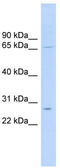 Mitochondrial Ribosomal Protein L13 antibody, TA334495, Origene, Western Blot image 