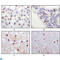Lysine Acetyltransferase 5 antibody, LS-C812788, Lifespan Biosciences, Immunohistochemistry paraffin image 
