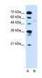 Retinoid X Receptor Gamma antibody, orb330023, Biorbyt, Western Blot image 