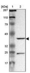 N-Myc Downstream Regulated 1 antibody, NBP1-82591, Novus Biologicals, Western Blot image 
