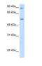 Glutamic--Pyruvic Transaminase antibody, NBP1-53177, Novus Biologicals, Western Blot image 