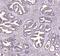 CD47 Molecule antibody, A00360-2, Boster Biological Technology, Immunohistochemistry paraffin image 