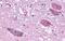 Opsin 3 antibody, GTX70609, GeneTex, Immunohistochemistry paraffin image 