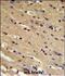Tumor Protein P73 antibody, A00688-1, Boster Biological Technology, Immunohistochemistry paraffin image 