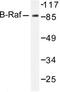 B-Raf Proto-Oncogene, Serine/Threonine Kinase antibody, LS-C176390, Lifespan Biosciences, Western Blot image 