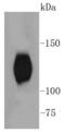 BDNF/NT-3 growth factors receptor antibody, A01388Y817, Boster Biological Technology, Western Blot image 