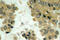 AKT Serine/Threonine Kinase 2 antibody, LS-C177636, Lifespan Biosciences, Immunohistochemistry frozen image 