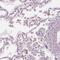 B And T Lymphocyte Associated antibody, NBP2-49354, Novus Biologicals, Immunohistochemistry frozen image 