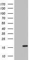 Interleukin 1 Receptor Antagonist antibody, M00651-2, Boster Biological Technology, Western Blot image 