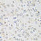 Albumin antibody, LS-C330935, Lifespan Biosciences, Immunohistochemistry paraffin image 