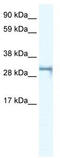 Short Stature Homeobox 2 antibody, TA333909, Origene, Western Blot image 