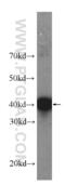 ALK Receptor Tyrosine Kinase antibody, 60321-1-Ig, Proteintech Group, Western Blot image 