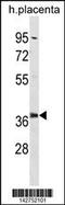 Proteasome 26S Subunit, Non-ATPase 6 antibody, 60-958, ProSci, Western Blot image 