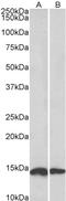 NADH:Ubiquinone Oxidoreductase Subunit S6 antibody, LS-B10455, Lifespan Biosciences, Western Blot image 