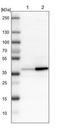 UDP-Galactose-4-Epimerase antibody, NBP1-87066, Novus Biologicals, Western Blot image 