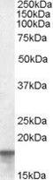 Anterior Gradient 2, Protein Disulphide Isomerase Family Member antibody, GTX89217, GeneTex, Western Blot image 