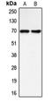 SLP-65 antibody, LS-C353418, Lifespan Biosciences, Western Blot image 