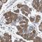 TPD52 Like 1 antibody, NBP1-84314, Novus Biologicals, Immunohistochemistry paraffin image 