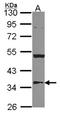 3-Hydroxy-3-Methylglutaryl-CoA Lyase antibody, NBP2-16860, Novus Biologicals, Western Blot image 
