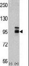 Fibroblast Growth Factor Receptor 4 antibody, MA5-11175, Invitrogen Antibodies, Western Blot image 