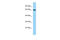 Ankyrin Repeat And Sterile Alpha Motif Domain Containing 1B antibody, ARP65995_P050, Aviva Systems Biology, Western Blot image 