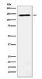 DExH-Box Helicase 9 antibody, M02550, Boster Biological Technology, Western Blot image 