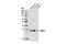 Voltage Dependent Anion Channel 2 antibody, 9412S, Cell Signaling Technology, Western Blot image 