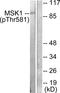 Ribosomal Protein S6 Kinase A5 antibody, LS-C199281, Lifespan Biosciences, Western Blot image 