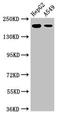 Leucine Rich Repeat Kinase 1 antibody, LS-C678525, Lifespan Biosciences, Western Blot image 