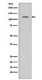 Telomerase Reverse Transcriptase antibody, M00012-2, Boster Biological Technology, Western Blot image 