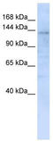 Interphotoreceptor Matrix Proteoglycan 2 antibody, TA342007, Origene, Western Blot image 