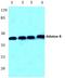 Aldolase, Fructose-Bisphosphate B antibody, A03893-1, Boster Biological Technology, Western Blot image 