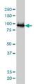 Ubiquitin Protein Ligase E3A antibody, H00007337-M01, Novus Biologicals, Western Blot image 
