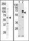 Receptor Like Tyrosine Kinase antibody, AP14421PU-N, Origene, Western Blot image 